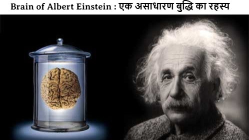 Brain of Albert Einstein